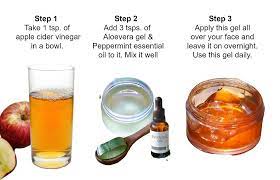 Homemade Apple Cider Vinegar Gel For Acne Pimples And Blemishes Apple Cider Vinegar For Skin Acne Gel Vinegar Gel