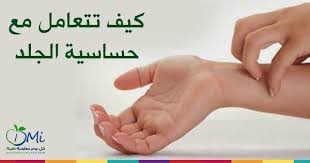 حساسية الجلد كثير منا عندما يرى بعض الاحمرار على جلده فيطلق على ذلك حساسية جلديه هناك اوجه كثيره لهذه الحساسيه بعضها مميت تأتي الحساسيه غالبا با