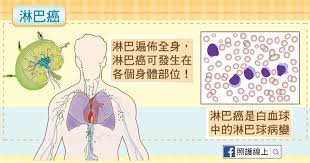 Anatomy what are the parts of the lymphatic system? ç'è«æ±ç¢å'³ç¦ éä½æ°é'æ°æ·å·´ç æ¶äººå ç§è­·ç·ä¸