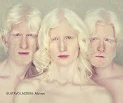 GUSTAVO LACERDA: Albinos von CEdelman