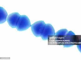 Image result for Group D Streptococcus