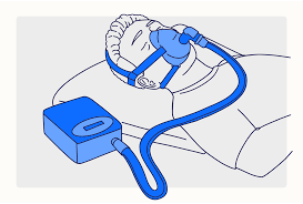 Image result for Sleep Apnea