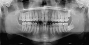 Dental X Ray2 By Nantel Via Flickr Dentaltown Dental Dental Hygenist