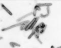 يحتوي إيبولا فيروس بصورة محصورة فردية وغير معدية على حمض نووي ريبوزي الجينوم. File Marburg Virus Jpg Wikimedia Commons