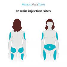 Push down on the plunger to inject the insulin. Best Insulin Injection Sites Absorption Time And Rotation