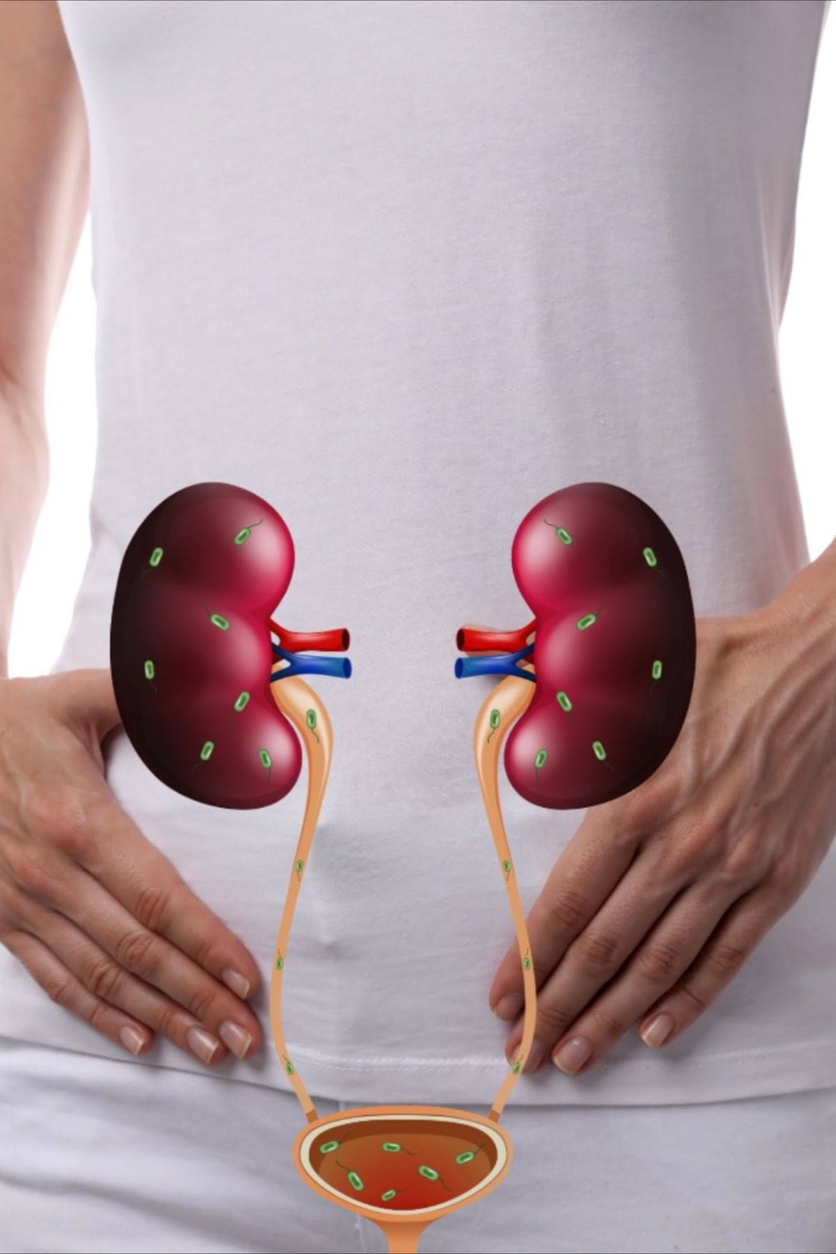 UTI Treatment in Bareilly | Expert Urology Care product image