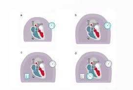 Image result for Preload