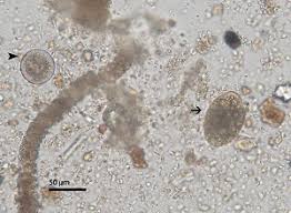 Image result for Balantoides Coli