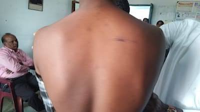Telangana Class 10 Student Beaten With Sticks, Bats By Seniors In Hostel Room
