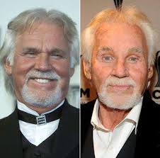 Celebrities Who Look Worse After Plastic Surgery Plastic Surgery Photos Bad Plastic Surgeries Botched Plastic Surgery