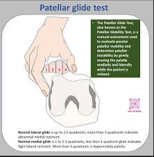 Image result for Ballottable Patella Sign