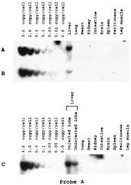 Image result for Black 1999 AAV