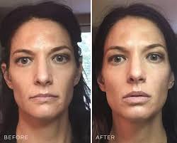 Microcurrent Facials — The Body Bungalow by Jill Helman