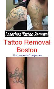 Pin On Tattoo Removal