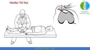 Image result for Patella Mobility Test