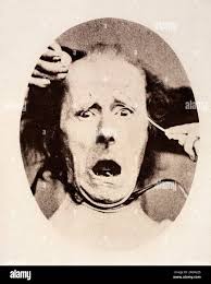 Darwin, C. R. 1872. The expression of the emotions in man and animals.  London: John Murray. First edition. A crop of a picture by Duchenne of he  and h Stock Photo