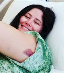 I was diagnosed with a blood clot in my spleen artery almost 2 months after  surgery (sleeve). Ive been having shortness of breath. Like a periodic  tight feeling in my chest when