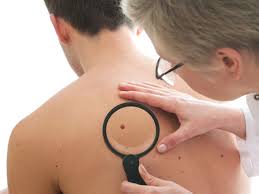 This form of melanoma occurs in all racial. Ai Can Detect Skin Cancer Better Than Doctors Now The Economic Times