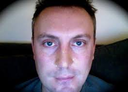 Gelatin Pore Strip Recipe: For Blackhead Removal at Home