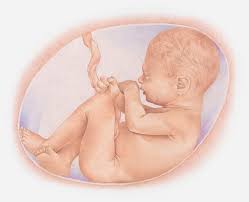 Contohnya pada saat kehamilan memasuki trimester tiga dinding rahim mengalami tekanan yang diakibatkan oleh bayi yang tumbuh semakin besar. Masalah Pada Cairan Ketuban Yang Bisa Memengaruhi Kondisi Bayi