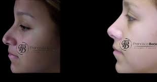 Dr Francisco Borja (@drfranciscoborja) • Instagram photos and videos