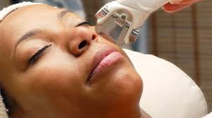 This is the best laser hair removal machine for thick hair but can also be used on faces, making it really versatile. The Best Laser Treatments For Dark Skin Allure