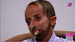 إيمان ضحية التنمر.. والدتها: كانوا بيقولوها انت سودة مش هتتجوزى