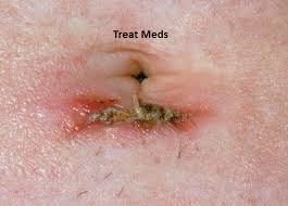 Pin On Itchy Skin