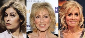 It up against a random cosmetic surgery procedure. Judith Light Plastic Surgery Before And After Pictures 2021