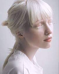 Minutiae The Small Precise Details That Makes One Unique The Finer Points And Subtleties Albinism Albino Model Portrait Inspiration