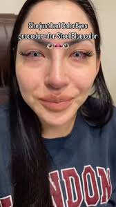 Brian Boxer Wachler, MD (@drboxerwachler) • Instagram photos and videos