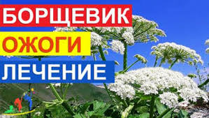 Этот сорняк распространяется в средней полосе россии каждый год все больше и больше. Borshevik Sosnovskogo Ozhogi I Lechenie Pervaya Pomosh Esli Vy Kosnulis Eto Yadovitoe Rastenie Universitet Zdorovogo Rebyonka Nyankovskih