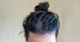 Oily Scalp Causes, Treatment, And Prevention: What You Need To Know