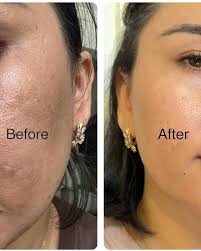 💛✨ ¡El retinol coreano que transforma tu piel en semanas! ✨💛 Despídete de  arrugas, poros y piel opaca con el Celimax Retinal Shot Tightening Booster,  el tratamiento anti-edad de alta eficacia que