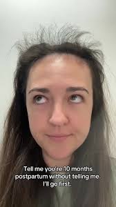 Is this what they mean when they say #babybangs ? #mom #mama #momlife  #momtok #postpartum #hairloss