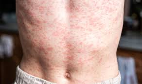 images?q=tbn:ANd9GcRHOeUGz4WIrw5X7dZExK0pzPpkYJ6fcSt2dA&s