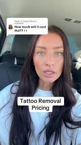 How Much Does It Cost for Tattoo Removal