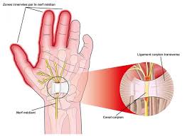 Image result for karp ln  tunel ort za