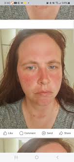 Please help me figure out my blood report.😬