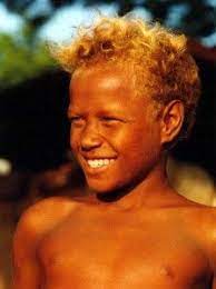 Blond hair and dark skin does occur frequently among children in the aboriginal people of australia and elsewhere in the south pacific. Think Dark Skinned People Aren T Naturally Blonde Think Again How Scientists Discovered The Genetic Differen Black And Blonde Melanesian People Black Skin