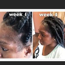 Regrow Your Edges Www Hairmogulme Com Herbal Hair Growth Natural Hair Wigs Natural Hair Salons