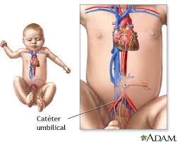 Hipertension Arterial En Bebes Medlineplus Enciclopedia Medica