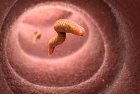 Check spelling or type a new query. 5 Parasiten Und Wurmer Im Menschlichen Korper Symptome Hausmittel