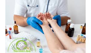 Image result for svrab na k%u016F%u017Ei