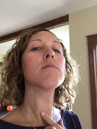 Hoarseness or other voice changes that do not go away. I Was Diagnosed With Thyroid Cancer