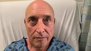 Delayed Unilateral Facial Weakness in COVID-19-Associated Guillain-Barré  Syndrome