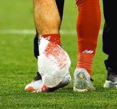 الدماء على قدم محمد صلاح عقب انتهاء مباراة أمس إليكم التفاصيل بالصور leg warmers warmers legs