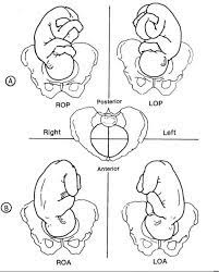 Anthro Doula Optimal Fetal Positioning