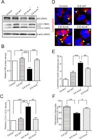 Salmonella bacteria typically live in animal and human intestines and are shed through feces. Salmonella Enteritidis Effector Avra Suppresses Autophagy By Reducing Beclin 1 Protein Biorxiv