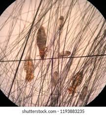 Image result for what do lice look like in dog fur